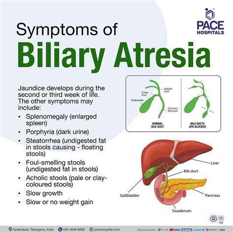 symptoms of bile leak|Bile Duct Leaks 